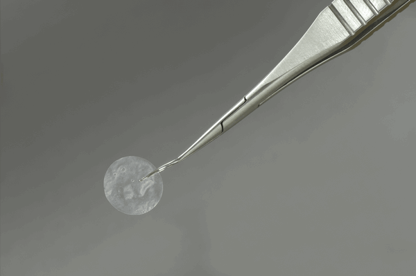 allograft